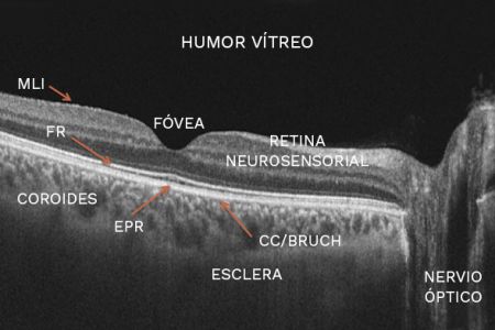 Estructura De Las Imágenes De La Retina OCT Artículo] Los Cambios